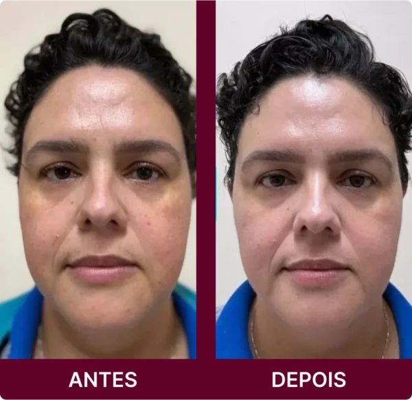 Rosa Amazônica® - Sérum Facial 11 Em 1 - Revitalize Sua Pele com a Rosa Mosqueta Amazônica - (Pague 5 FRASCOS e Leve 5 E-books Grátis) 60% OFF - Image 6